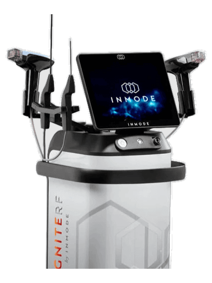 IgniteRF