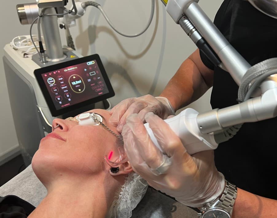 Fraxis CO2 Fractional laser