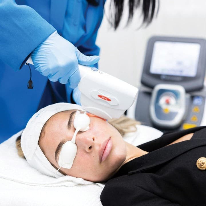 IPL Photo Rejuvenation