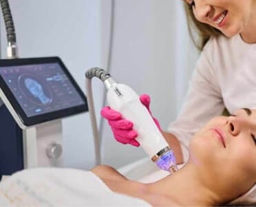 Secret RF Microneedling