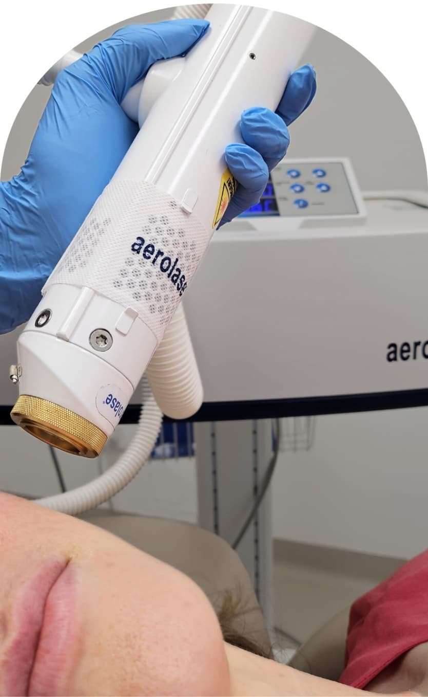 Aerolase Neo Elite Laser