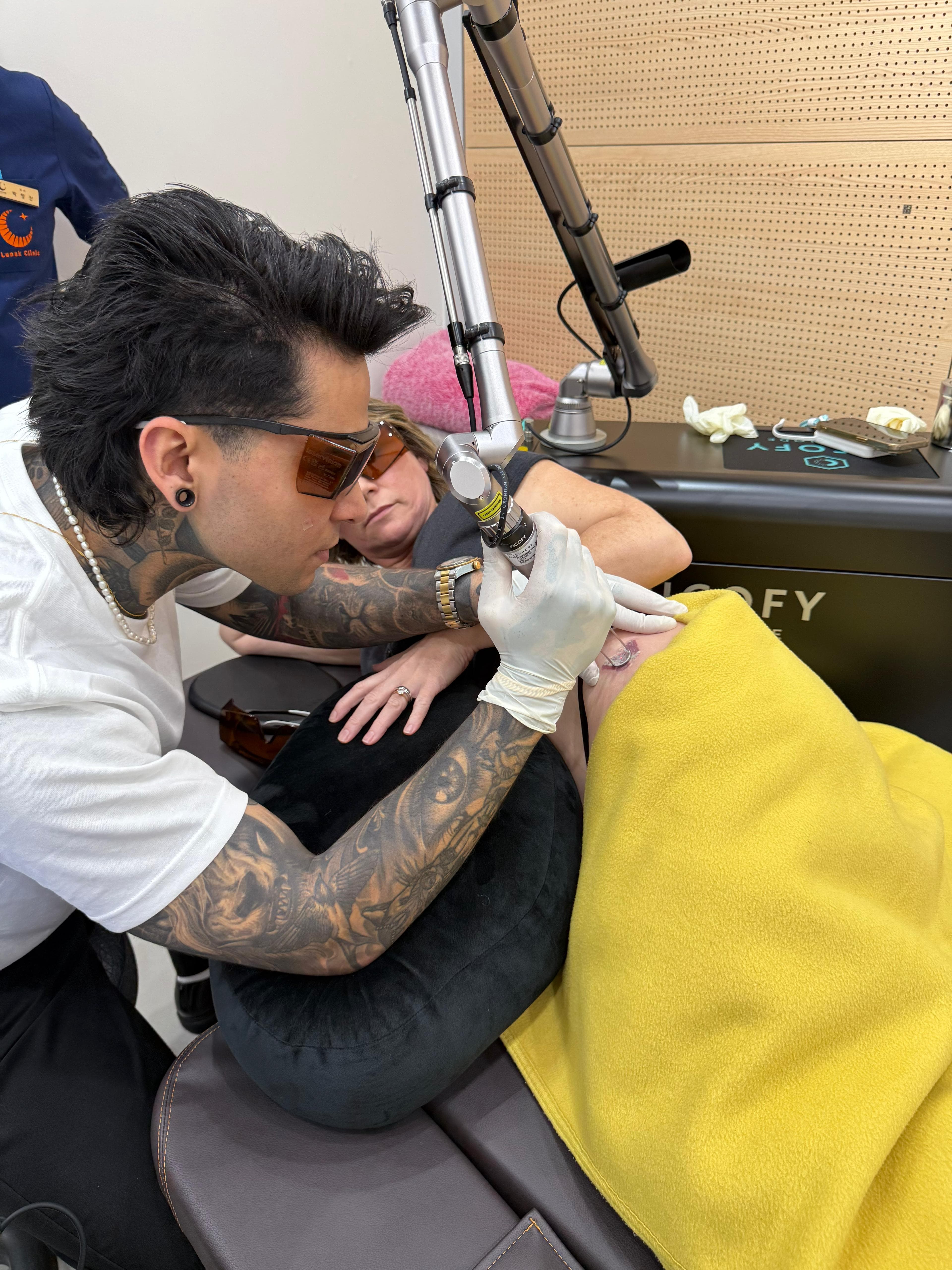 Pico Tattoo Removal