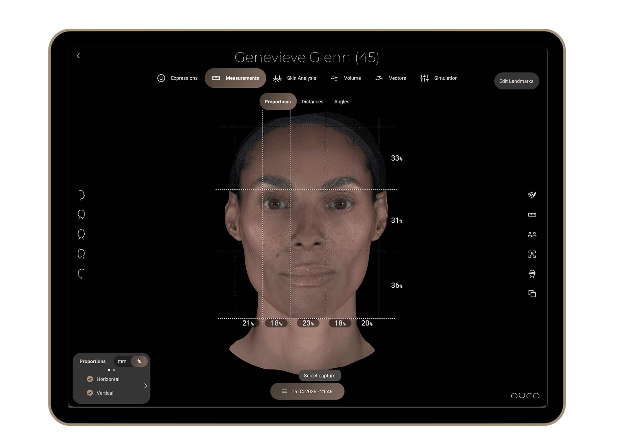 Aura 3D Imaging