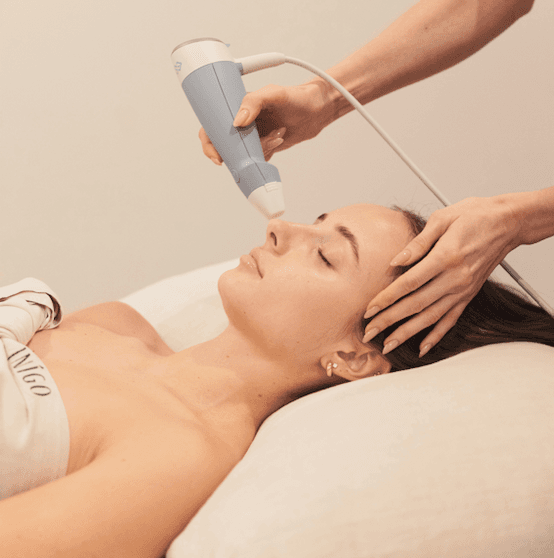 Exion RF Microneedling
