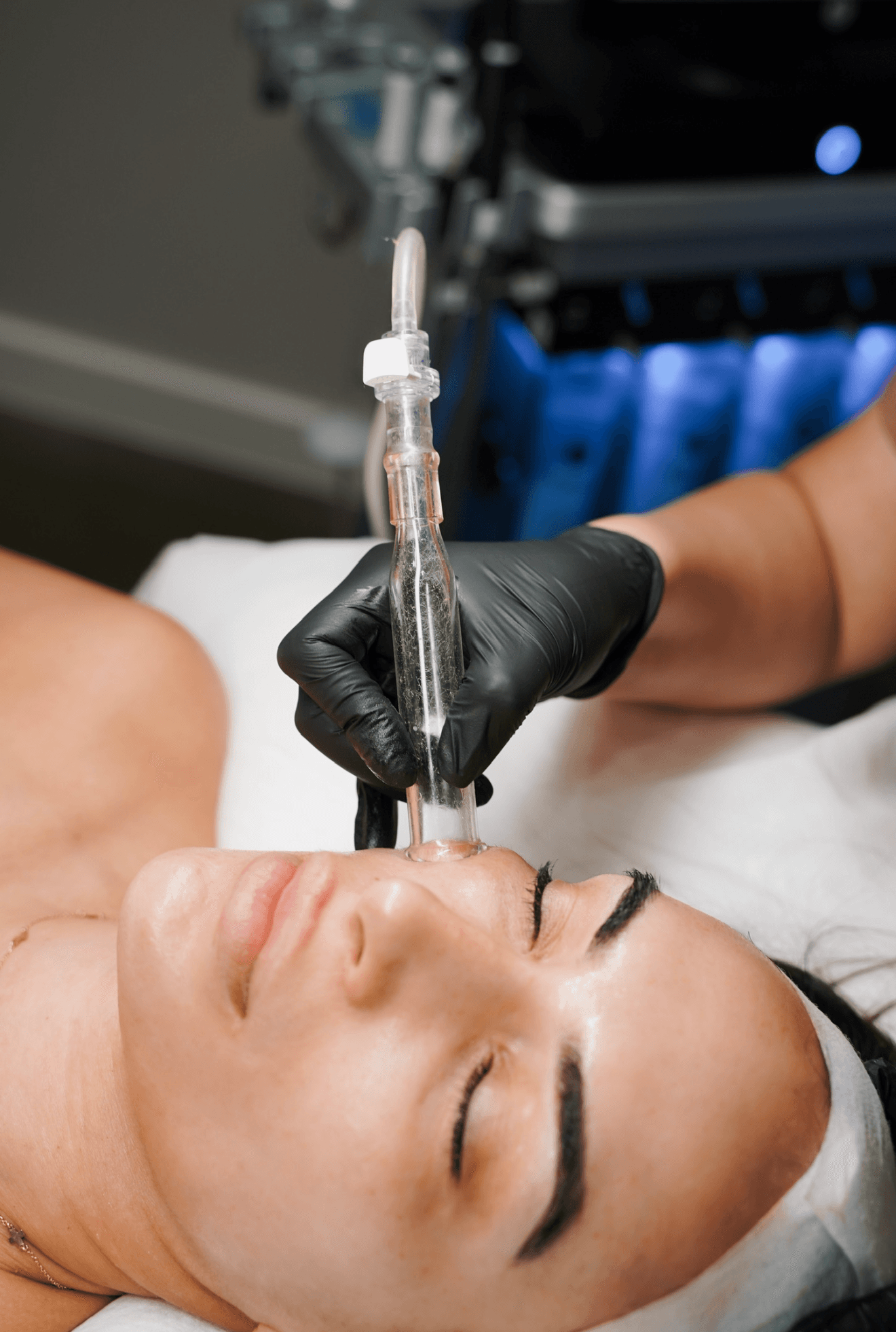 Hydrafacial — image 2