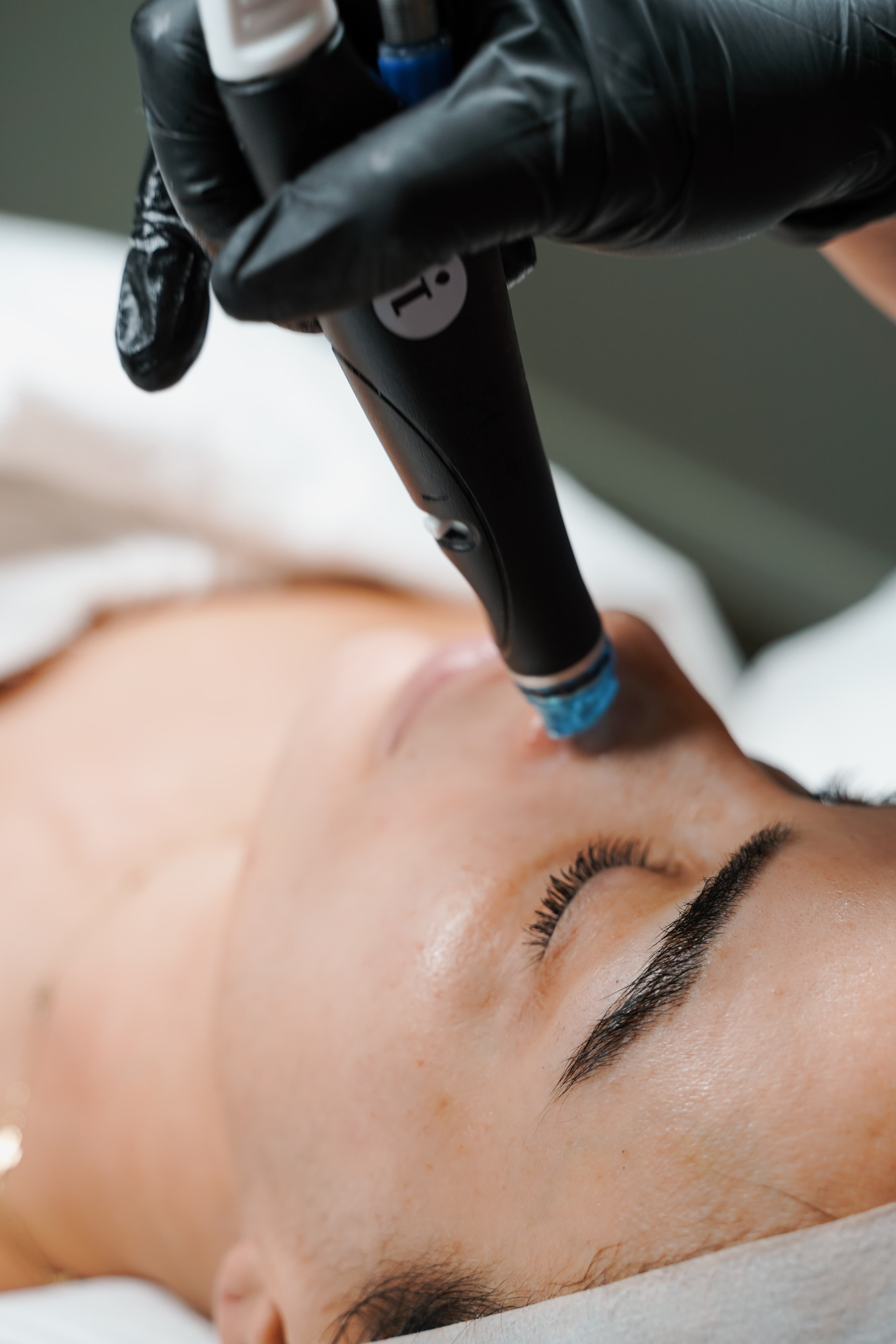 Hydrafacial