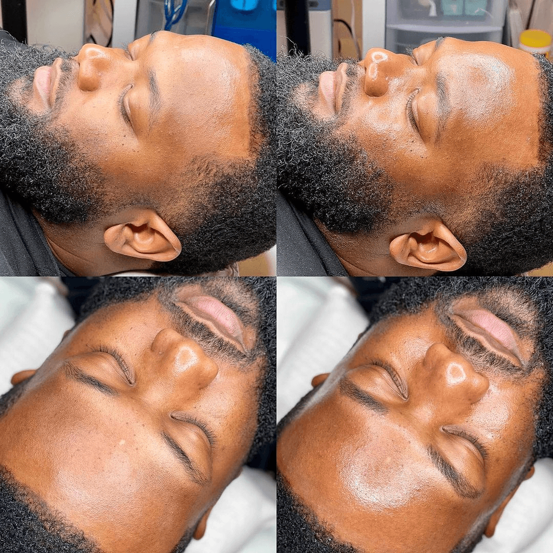 Hydrafacial Premium — image 5