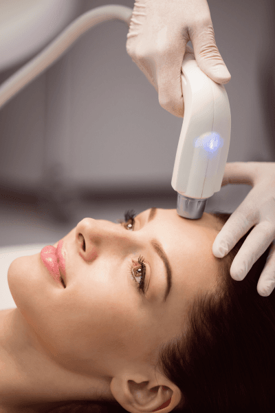 QUADESSY RF MICRONEEDLING