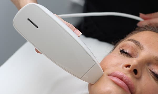 Venus Viva Skin Rejuvenation & Tightening — image 3