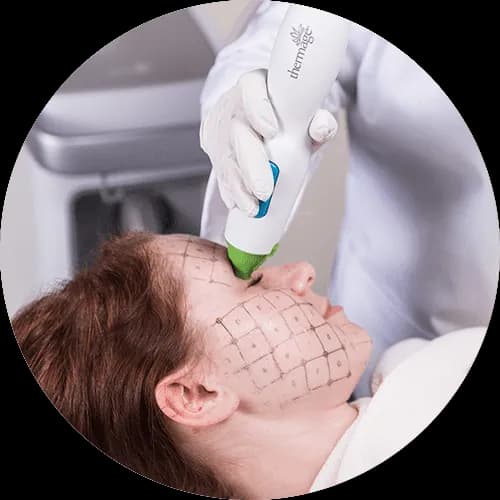 Thermage FLX Eye